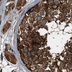 PEX5 Antibody in Immunohistochemistry (Paraffin) (IHC (P))