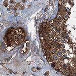 PEX5 Antibody in Immunohistochemistry (Paraffin) (IHC (P))