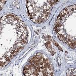 TRAFD1 Antibody in Immunohistochemistry (IHC)