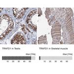 TRAFD1 Antibody