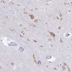 SKA3 Antibody in Immunohistochemistry (Paraffin) (IHC (P))