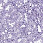 SKA3 Antibody in Immunohistochemistry (Paraffin) (IHC (P))