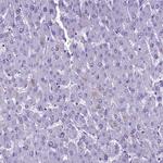 SKA3 Antibody in Immunohistochemistry (Paraffin) (IHC (P))