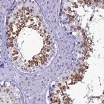 SKA3 Antibody in Immunohistochemistry (Paraffin) (IHC (P))