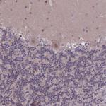 DIS3 Antibody in Immunohistochemistry (Paraffin) (IHC (P))