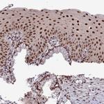 DIS3 Antibody in Immunohistochemistry (Paraffin) (IHC (P))