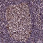 DIS3 Antibody in Immunohistochemistry (Paraffin) (IHC (P))