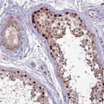 DIS3 Antibody in Immunohistochemistry (Paraffin) (IHC (P))