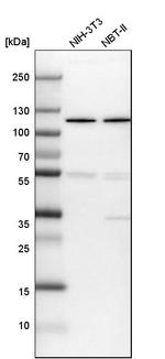 DIS3 Antibody in Western Blot (WB)