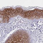 Spectrin beta-3 Antibody in Immunohistochemistry (IHC)