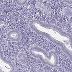 Spectrin beta-3 Antibody in Immunohistochemistry (IHC)