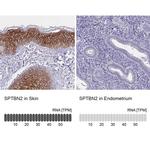 Spectrin beta-3 Antibody