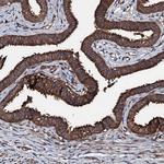 KIF18A Antibody in Immunohistochemistry (Paraffin) (IHC (P))