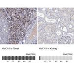 HVCN1 Antibody in Immunohistochemistry (IHC)