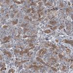 POLR1D Antibody in Immunohistochemistry (Paraffin) (IHC (P))