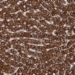 N4BP2L2 Antibody in Immunohistochemistry (Paraffin) (IHC (P))