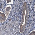 N4BP2L2 Antibody in Immunohistochemistry (IHC)