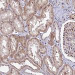 ZC3H13 Antibody in Immunohistochemistry (Paraffin) (IHC (P))