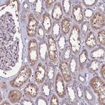 USPL1 Antibody in Immunohistochemistry (Paraffin) (IHC (P))