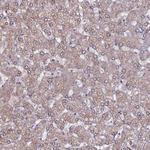 USPL1 Antibody in Immunohistochemistry (Paraffin) (IHC (P))