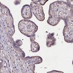 USPL1 Antibody in Immunohistochemistry (Paraffin) (IHC (P))