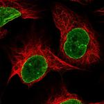 RNF6 Antibody in Immunocytochemistry (ICC/IF)