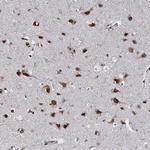 RNF6 Antibody in Immunohistochemistry (Paraffin) (IHC (P))