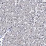 RNF6 Antibody in Immunohistochemistry (Paraffin) (IHC (P))