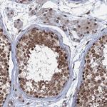 RNF6 Antibody in Immunohistochemistry (Paraffin) (IHC (P))