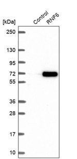 RNF6 Antibody in Western Blot (WB)