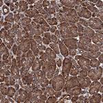 CKAP5 Antibody in Immunohistochemistry (Paraffin) (IHC (P))