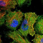 IP6 Kinase Antibody in Immunocytochemistry (ICC/IF)