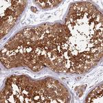 IP6 Kinase Antibody in Immunohistochemistry (Paraffin) (IHC (P))