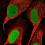 RNMT Antibody in Immunocytochemistry (ICC/IF)