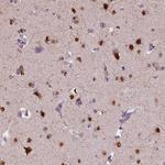 RNMT Antibody in Immunohistochemistry (Paraffin) (IHC (P))