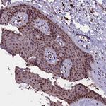 RNMT Antibody in Immunohistochemistry (Paraffin) (IHC (P))