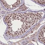 RNMT Antibody in Immunohistochemistry (Paraffin) (IHC (P))