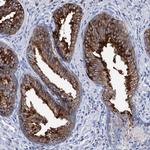 BBS4 Antibody in Immunohistochemistry (Paraffin) (IHC (P))