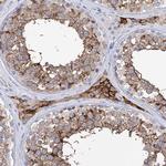 BBS4 Antibody in Immunohistochemistry (Paraffin) (IHC (P))