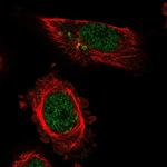 MED13L Antibody in Immunocytochemistry (ICC/IF)