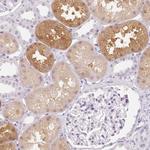 MIOX Antibody in Immunohistochemistry (Paraffin) (IHC (P))