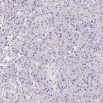 MIOX Antibody in Immunohistochemistry (IHC)