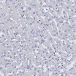 AMER2 Antibody in Immunohistochemistry (Paraffin) (IHC (P))