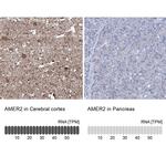 AMER2 Antibody in Immunohistochemistry (IHC)