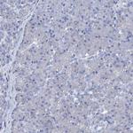 AMER2 Antibody in Immunohistochemistry (IHC)