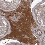 USP50 Antibody in Immunohistochemistry (Paraffin) (IHC (P))