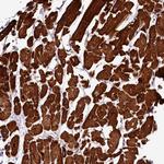 RAPSN Antibody in Immunohistochemistry (Paraffin) (IHC (P))