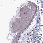 RAPSN Antibody in Immunohistochemistry (Paraffin) (IHC (P))