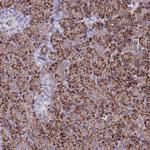 ALDH1L2 Antibody in Immunohistochemistry (Paraffin) (IHC (P))