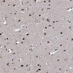 KIF18A Antibody in Immunohistochemistry (Paraffin) (IHC (P))